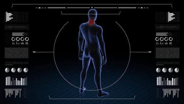 Man with pathology. 3d body of boy. Male human figure.