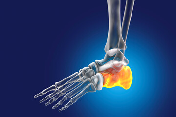 Human foot anatomy. Calcaneus bone of the foot - obrazy, fototapety, plakaty