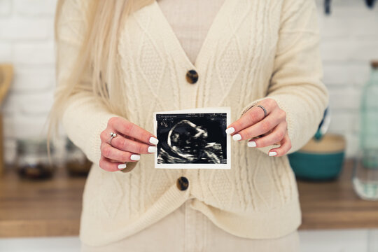 White unrecognisable woman wearing a knitted sweater holding up ultrasound photo of baby to the camera. Close up Indoor shot. High quality photo
