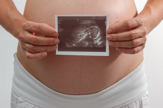 Pregnant woman hands holding ultrasound photo