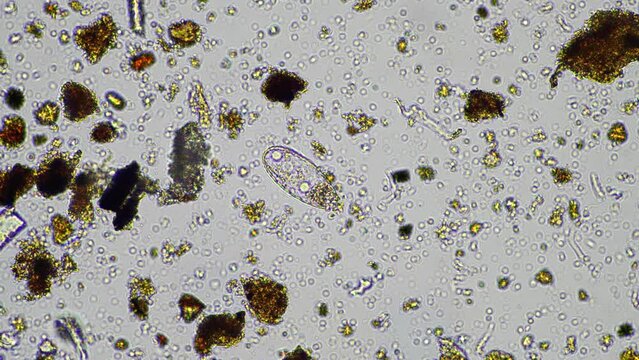 microorganisms living under the microscope