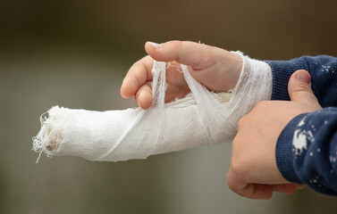 Broken arm in a cast in a boy.