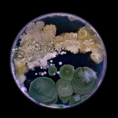Samples of Petri dishes with a culture of microorganisms and fungi in the surface of agar nutrient...
