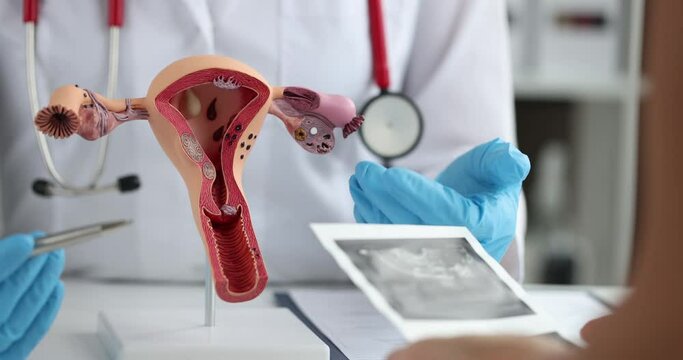 Model of the female reproductive system, ultrasound uterus