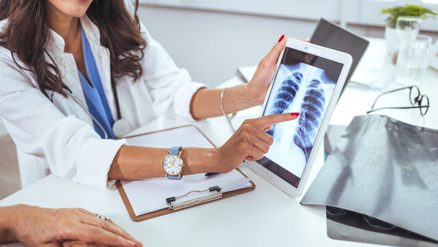 Doctor with radiological chest x-ray film for medical diagnosis on patient's health on asthma, lung disease and bone cancer illness. Lung cancer medical. Doctor explaining results of lung check up 