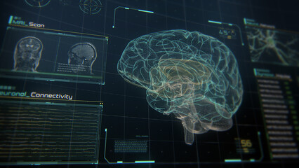 3D Illustration of Modern Medical Interface showing Brain, MRI Scans, Neurons and Data.