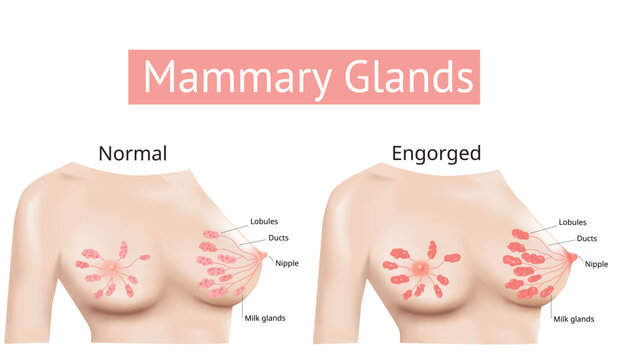 Mammary gland, Non-Lactating and Engorged breast, Female breast Anatomy, illustration Vector.