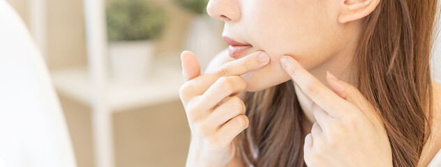Dermatology, puberty asian young woman, girl looking into mirror, allergy when wear mask and...