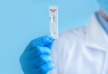 A doctor or nurse wearing a protective mask and gloves shows a rapid laboratory test for Express Monkeypox virus (MPXV) test to detect IgM and IgG antibodies to the new coronavirus. Negative result