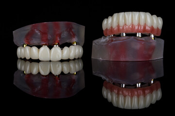 excellent dental composition of two models with upper and lower jaw prostheses on black glass with reflection