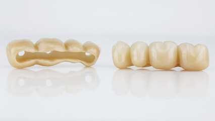 excellent dental composition of bridges of prostheses from zircon without a beam on a white...