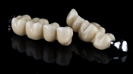 two dental prosthesis bridges made of zircon and pure titanium on a black background
