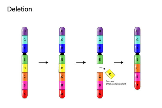 Chromosome Deletion. Genetic mutation. Alteration of chromosome structure. Vector for scientific study and biological genetics.