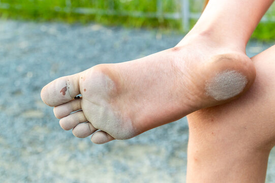 Dirty sole of a child's bare foot
