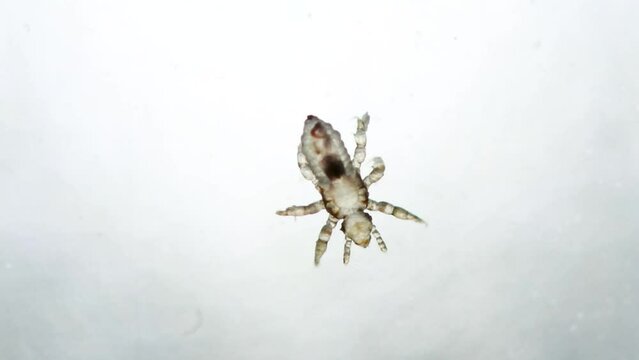 Nymfa of head lice in extreme lookup walking on white surface. Real extreme macro photo. Human infectious disease. Pediculus capitis. Closeup video of human parasite in growing phase.
