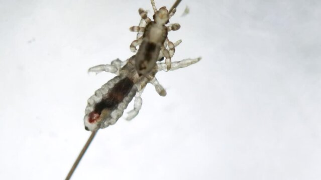 Head louse on a human hair with small head lice walking above her. Extreme closeup detail of human parasite above white background. Pediculus capitis. Human infectious disease.