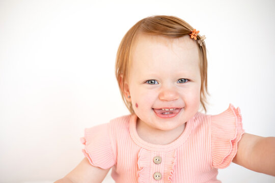 Portrait of a charming funny red-haired baby girl with blue eyes and a birthmark on her cheek. Hemangioma. Light background. Lifestyle