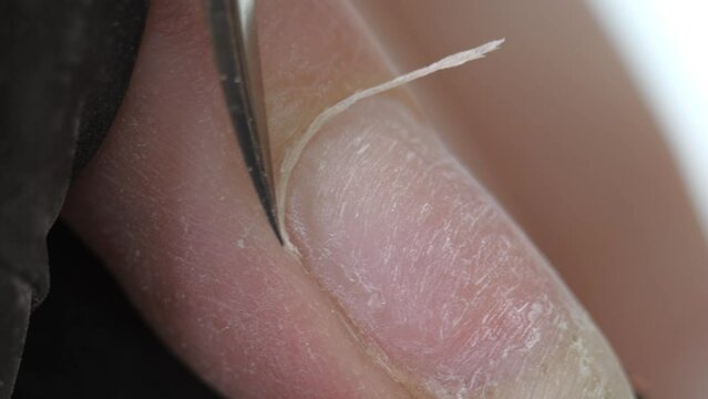 Pruning at the nail cuticle with manicure scissors. Hardware combined manicure.