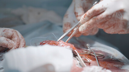 Surgeons cutting flesh. Action. Close-up of surgical intervention in male genital organ. Bloody...