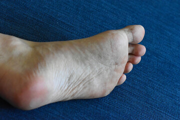 foot on a blue background