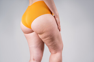 Overweight thigh, woman with fat hips and buttocks, obesity female body with cellulite on gray background - obrazy, fototapety, plakaty