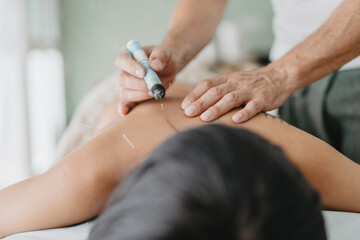 pure moxa by heating the area where an acupuncture needle is pricked