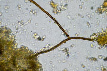 Soil fungi in a soil sample on a farm in outback Australia, under the microscope of fungal hyphae...