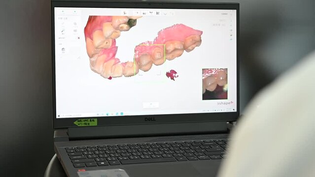 3 shape Dental 3D Scanners monitor