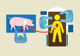 Genetically Modified Pig's Heart Transplanted to a Human Host. Editable Clip Art.