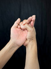Fototapeta premium Trigger Finger a defect in a tendon causing a finger to jerk or snap straight when the hand is extended.
