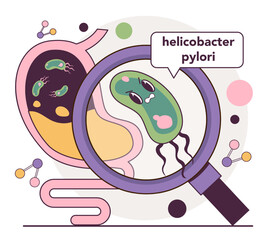 Helicobacter pylori in the stomach. Bacterium with flagella that causes