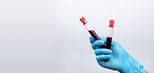 Test tubes with blood for analysis in a hand in a blue medical glove.  On a white background.  Lots of empty space