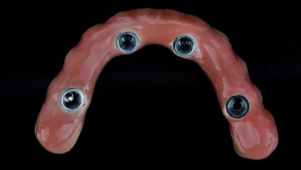 View of the gum prosthesis of the lower jaw from ceramic on a black background