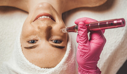 Cosmetologist's hand doing procedure of microneedling to the patient's smiling face. Aesthetic...