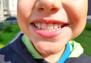 Boy showing white healthy teeth. Selective focus.