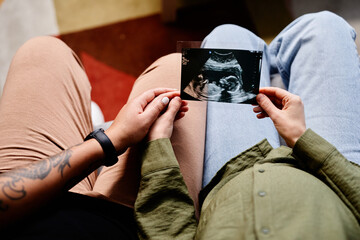 Close up of tattooed gay couple with pregnant young woman looking at ultrasound image of baby, same sex family - obrazy, fototapety, plakaty