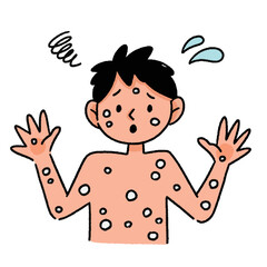 サル痘　男性　イラスト