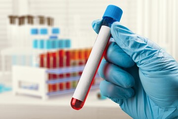 doctor holding Blood tube for Virus analysis and identification.