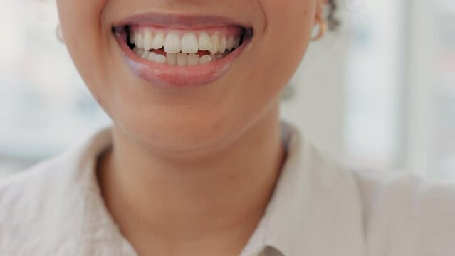 White teeth, a laughing smile and closeup of a girl after her oral whitening treatment. Mouth of one young woman with big smile on her face, feeling good after her orthodontist or dentist appointment