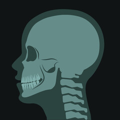 Xray of skull, scan for diagnostics and treatment