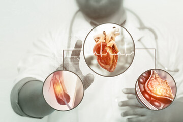 Doctor check and diagnose the human heart diseases. Cholesterol plaque in artery. Stent angioplasty. 3d illustration