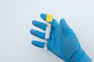 Vacuum tube for collection and blood samples with sodium citrate in blue gloves for laboratory. On...