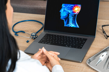 Doctor showing a x-ray of pain in the brain on a laptop. Migraine Headache