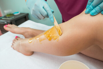 Woman undergoing leg hair removal procedure with sugaring paste in salon