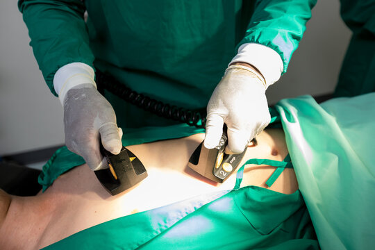 The doctor is giving a defibrillators to save the patient's life in the hospital. CPR. Using a defibrillator to save lives. Hands of man surgeon holding defibrillator at the hospital
