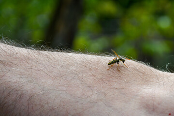The bee sat on a man's hand