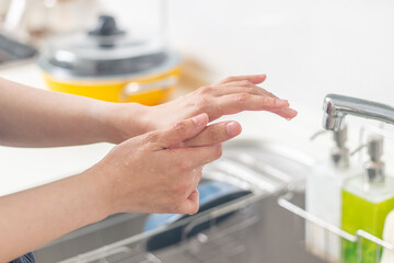 手荒れを気にしている女性