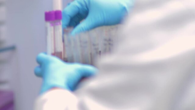 4k real time - hospital staff carrying out medical research in the laboratory with pipettes, test tubes, samples, etc...