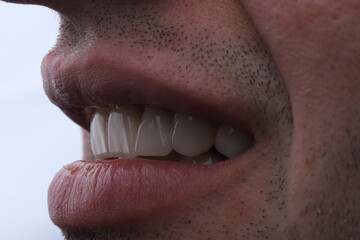 Obraz premium smile teeth tooth mouth lip palate dentist nose