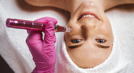 Cosmetician making anti-aging therapy to the patient's face using dermapen. Beauty treatment....